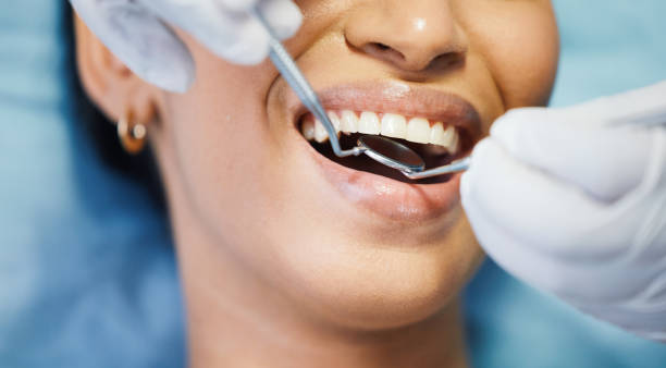 Best Emergency Cosmetic Dentistry (e.g., broken veneers) in USA